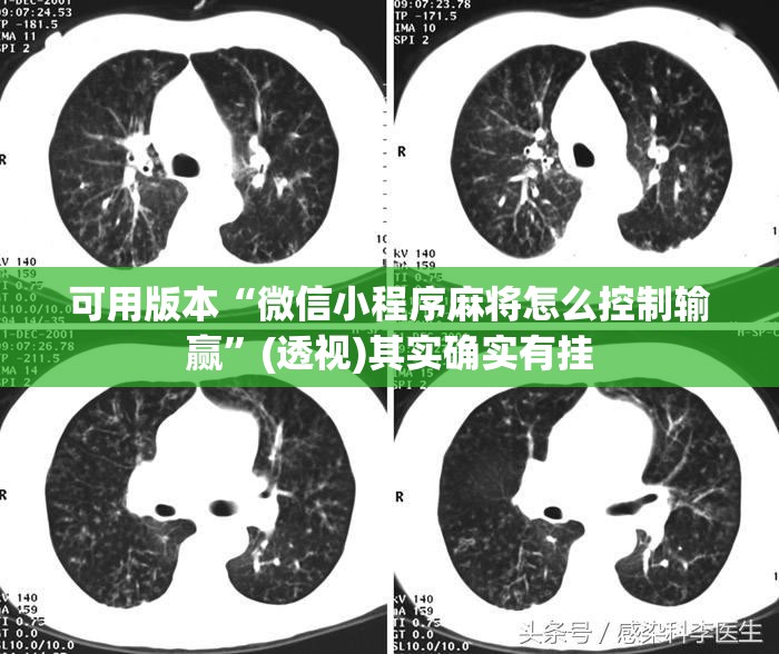 可用版本“微信小程序麻将怎么控制输赢”(透视)其实确实有挂